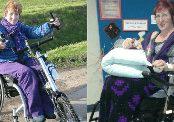 Sharon posing on her bike and shortly after being discharged from hospital
