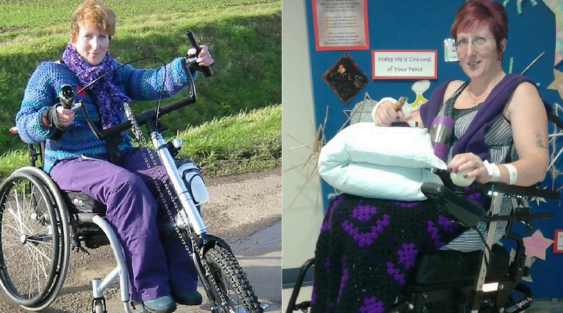 Sharon posing on her bike and shortly after being discharged from hospital